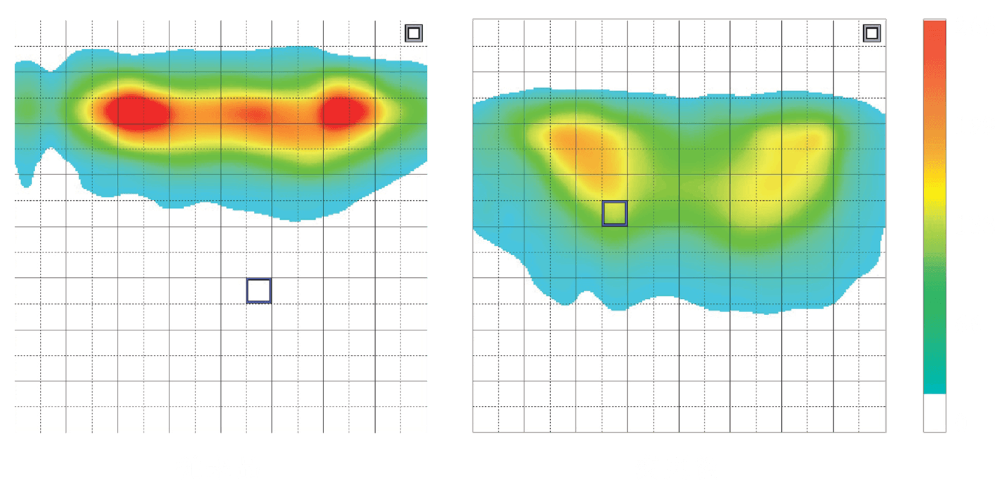 支撐身體廣闊的區域